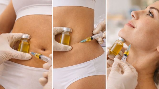 Bodyshaping in Hanau: Moderne Methoden zur Körperformung ohne Operation